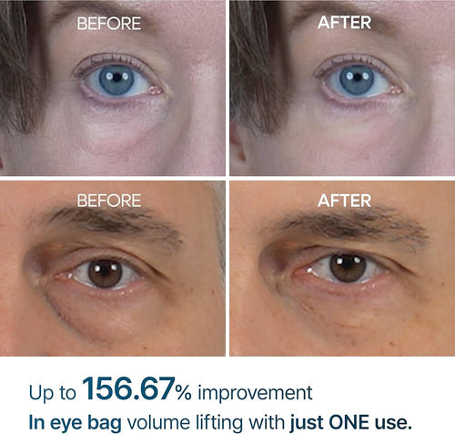Dr. Melaxin Eyephalt Eyebag Cream 10ml